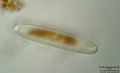 Pinnularia sp
